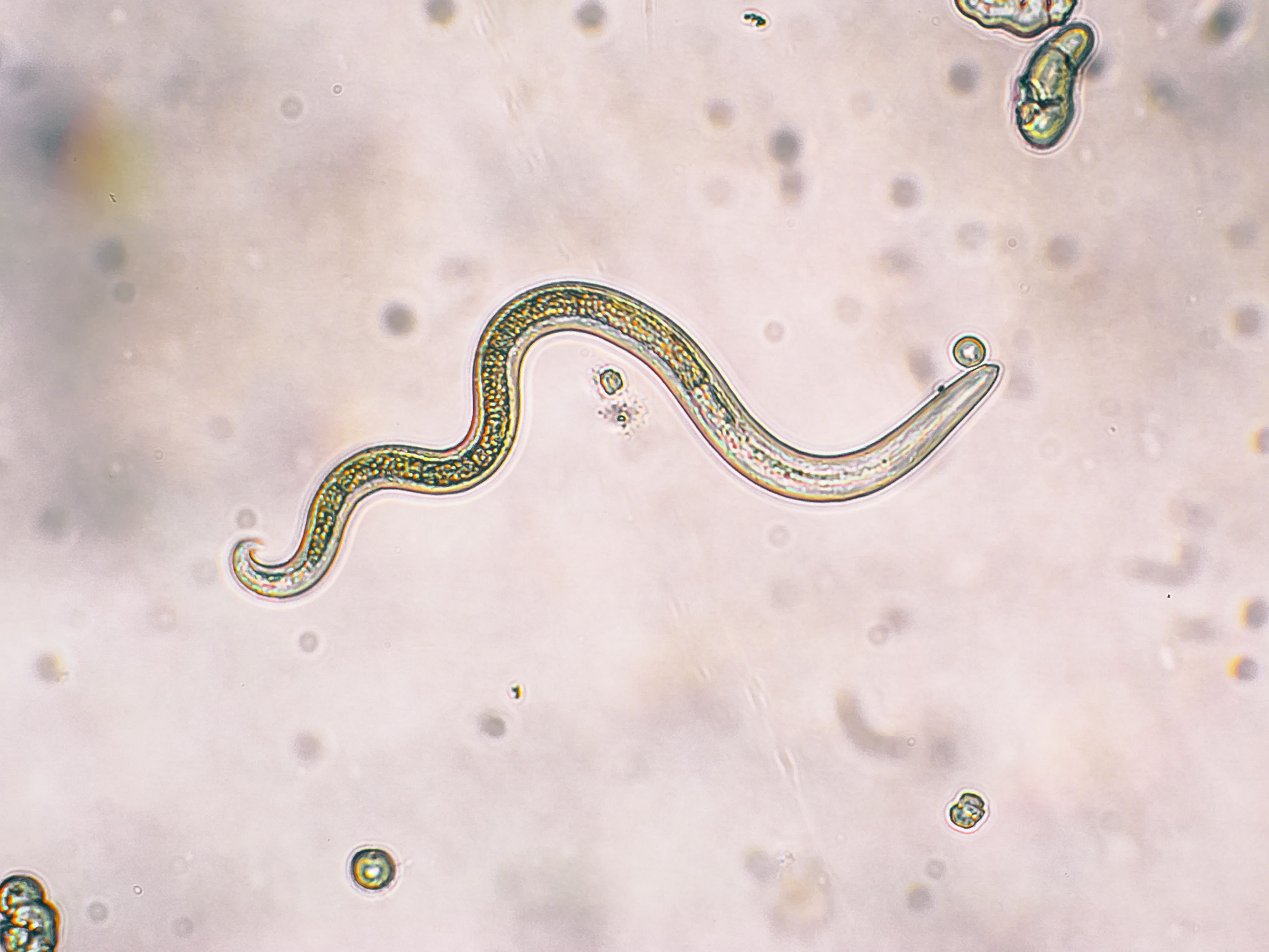 roundworm